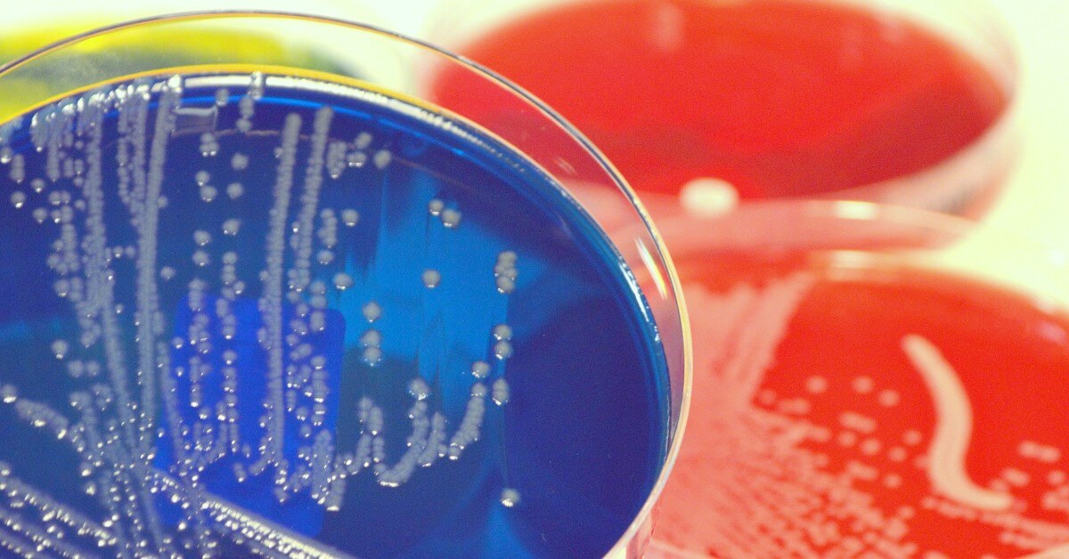 Przyczyny zaburzeń mikrobiomu