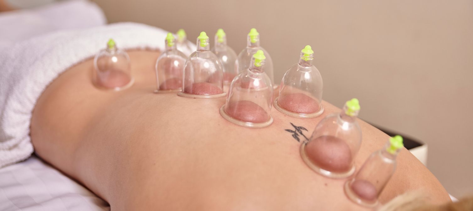 naturalna terapia bańkami z Bliskiego Wschodu