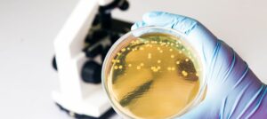 Wpływ pory dnia na mikrobiom