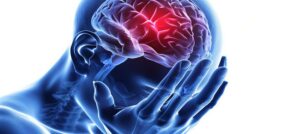 Stymulacja nerwu błędnego