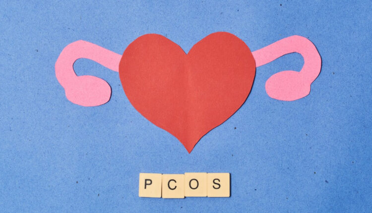 PCOS jest skorelowane z wystąpieniem zaburzeń psychicznych