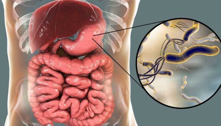 Helicobacter pylori może powodować wrzody żołądka
