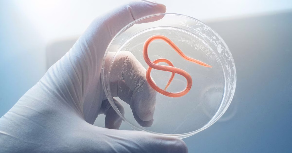 Jak można się ochronić przed pasożytami?