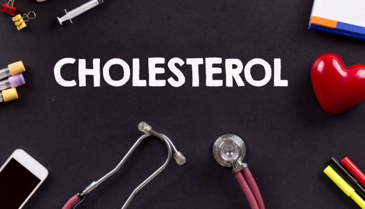 Jaka jest prawda o cholesterolu i chorobach sercowo-naczyniowych? – rozmawiamy o tym z prof. dr hab. n. med. Andrzejem Frydrychowskim