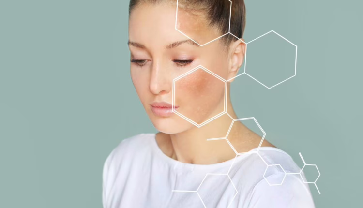 Domowe sposoby na rogowacenie okołomieszkowe