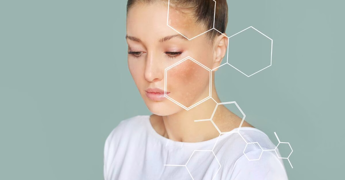 Domowe sposoby na rogowacenie okołomieszkowe