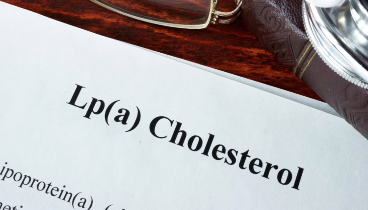 zaburzenia metabolizmu lipoprotein i inne lipidemie